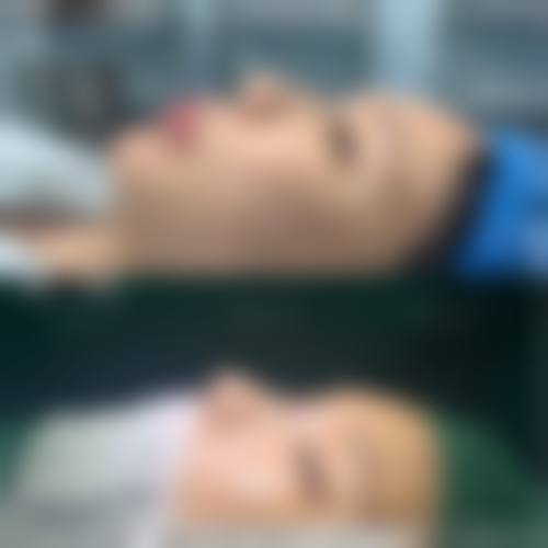 九、福州市台江区星龄医疗美容门诊部真实的患者评价