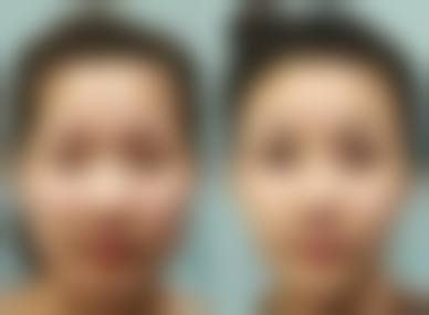 六、长沙花容荟医疗美容诊所价格表