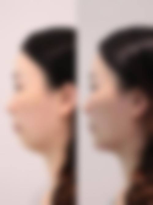 六、重庆威妮医疗美容医院价格表