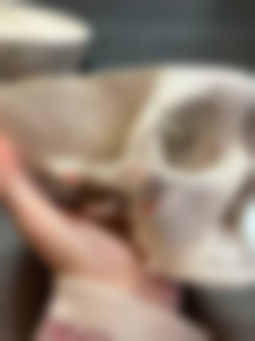 八、红安县天美优嘉整形医院真实的患者评价