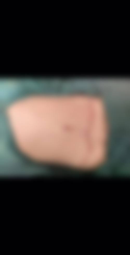 四、杭州强生男科医院特色项目