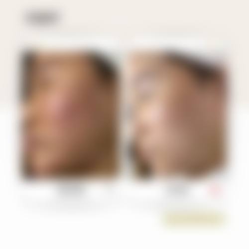 三、杭州强生男科医院诊疗项目有哪些？