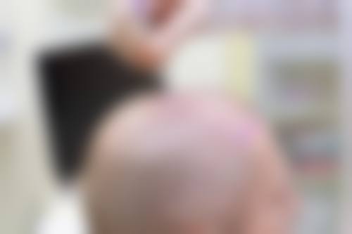 二、成都青羊首瑞植发医院怎么样？