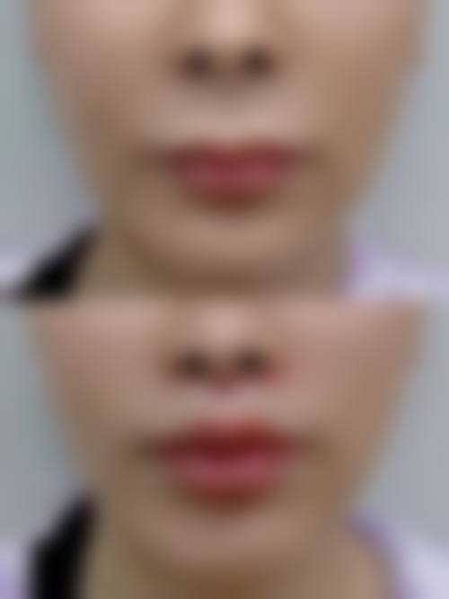 三、桑宇奇技术优势