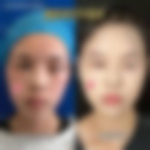 二、邯郸好美医疗美容门诊部怎么样？