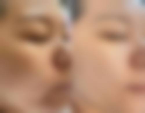 九、长春伊美医疗美容门诊部真实的患者评价