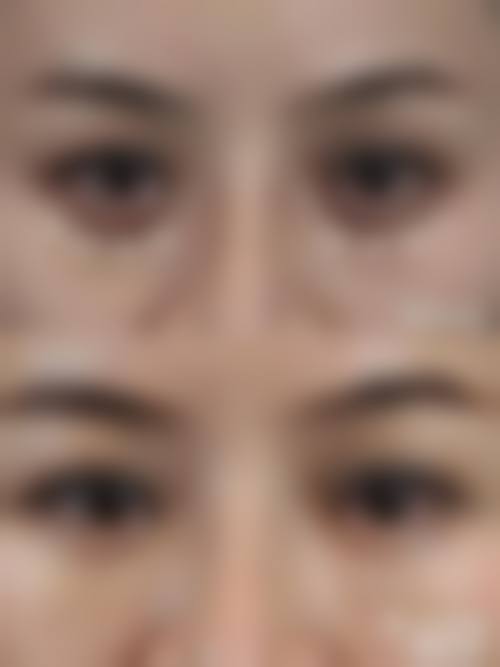 八、成都高新悦妍悦蜜整形医院真实的患者评价