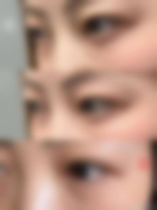 四、成都高新悦妍悦蜜整形医院特色项目