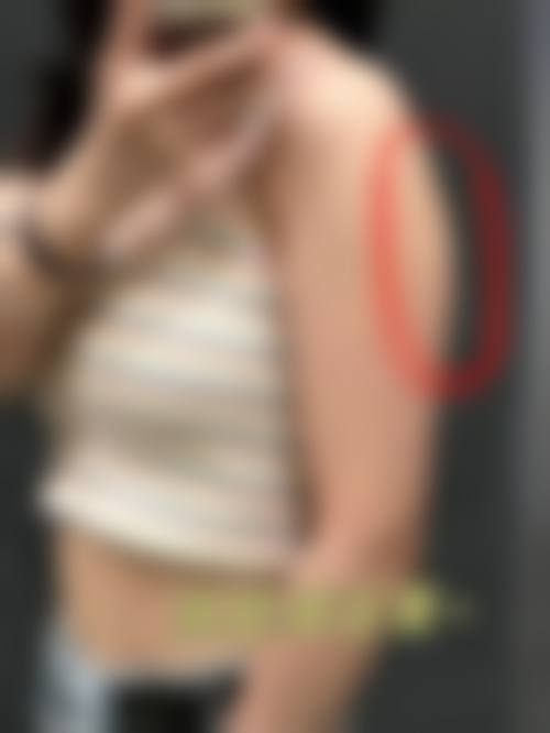 八、北京悦美好医整形医疗美容真实的患者评价