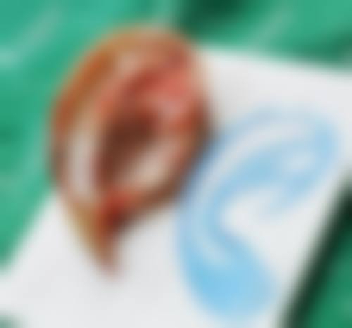 五、成都泊莱瑞整形医院价格表