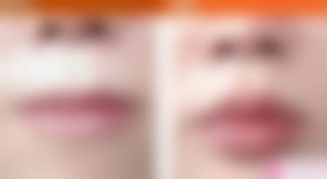 七、苏州同济整形医院预约方式