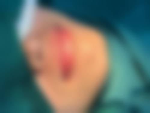 三、宁波壬美整形外科医院诊疗项目有哪些？