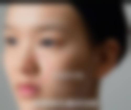 四、红安县天美优嘉整形医院特色项目