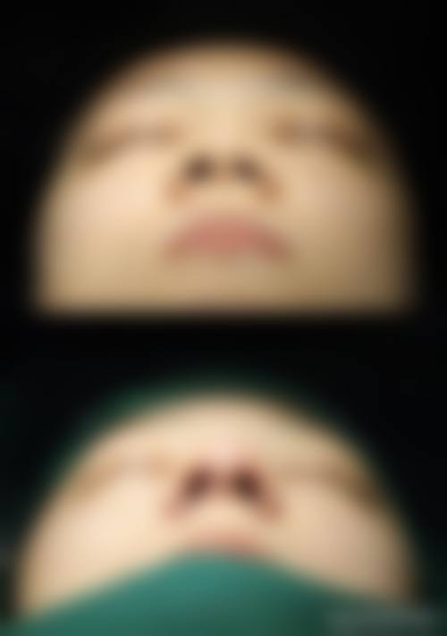 四、玉溪市人民医院（口腔颌面整形外科）特色项目