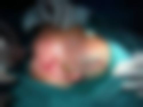 三、梧州市中医医院整形美容科诊疗项目有哪些？