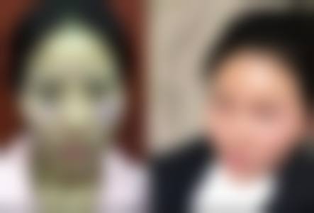 九、宁波壬美整形外科医院真实的患者评价