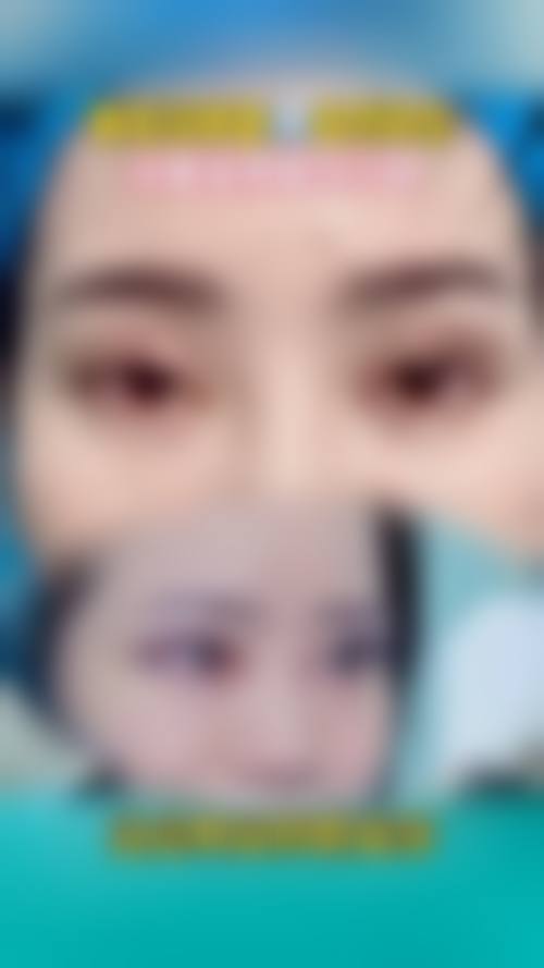 九、北京军区总医院美容整形医院真实的患者评价