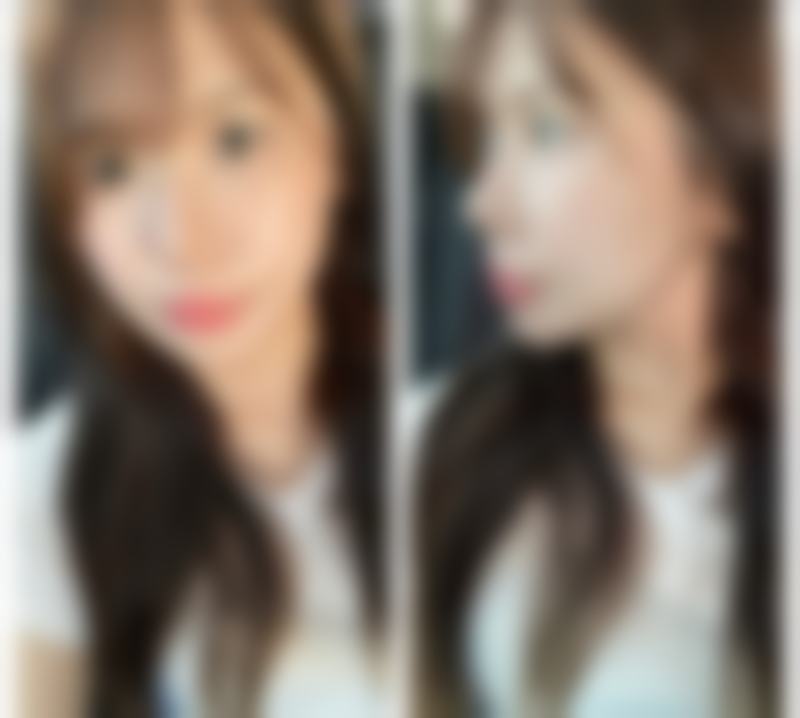 三、湖北孝感星诺整形诊疗项目有哪些？