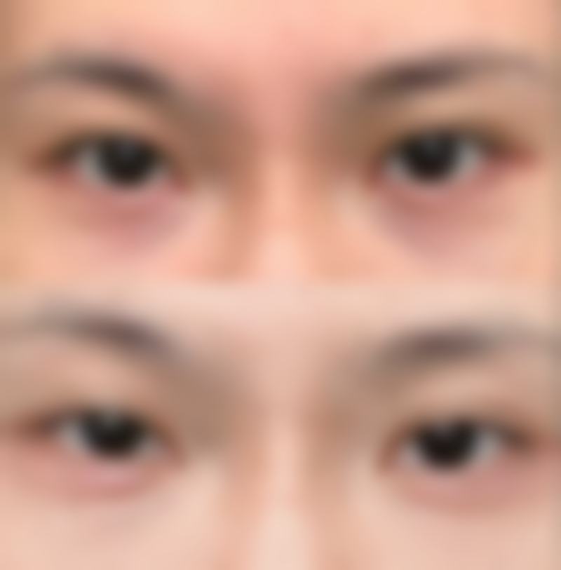 五、梧州市中医医院整形美容科价格表