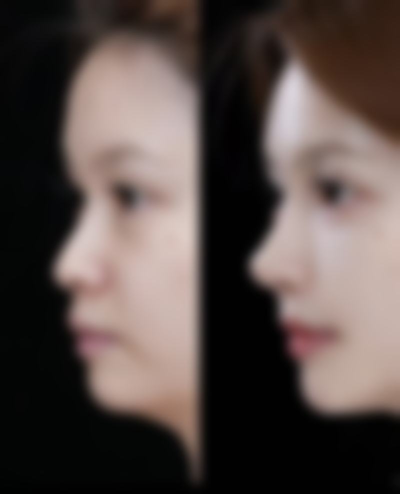 四、福州市台江区星龄医疗美容门诊部特色项目