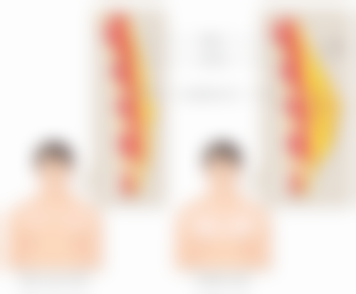 三、怎么才能除疤痕体质之医美改善方案