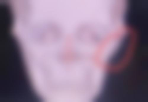 一、平价热门去眼袋眼膜