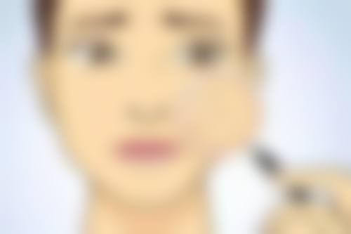 四、青春魔法棒除皱成效怎么样之实际实例分享