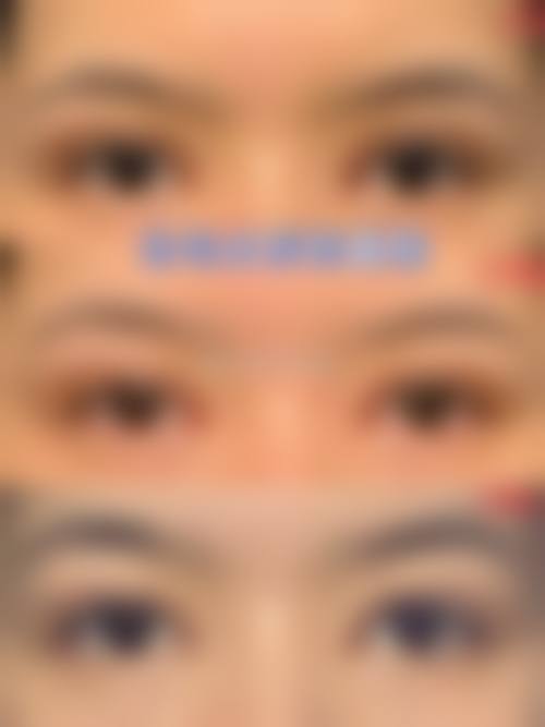 九、杭州滨江医疗美容诊所真实的患者评价