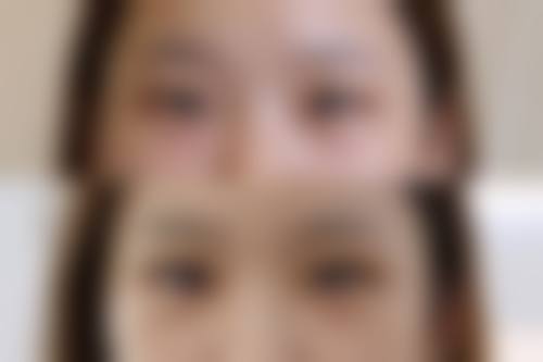 四、佛山美嘉美医疗美容门诊部特色项目