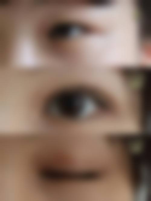 九、温州环亚医疗美容门诊部真实的患者评价