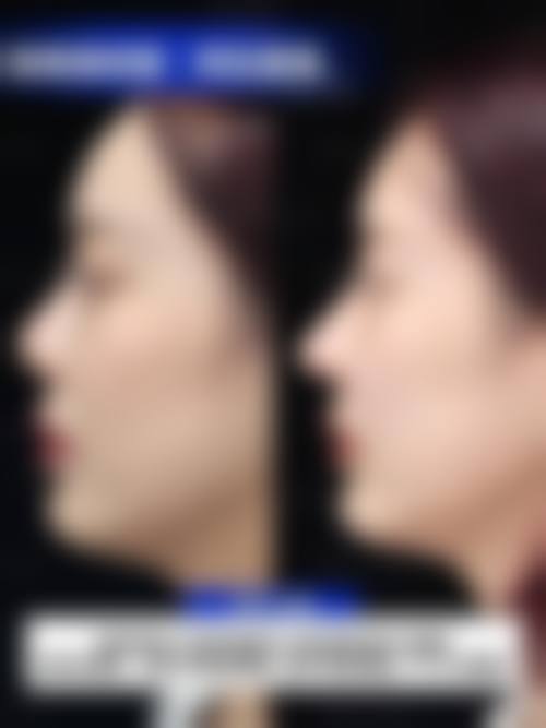 二、哈尔滨市第一医院怎么样？