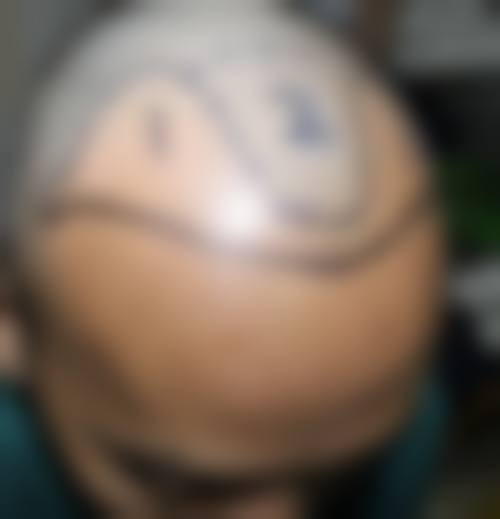 三、安庆石化医院医学美容中 心诊疗项目有哪些？