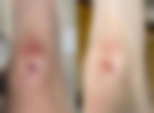 六、深圳南方激光整形美容地址及交通