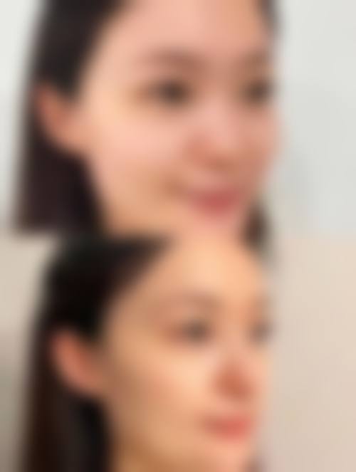 九、泉州黄氏医疗美容诊所真实的患者评价