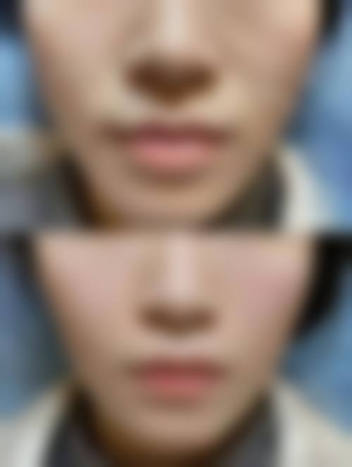 八、深圳南方激光整形美容真实的患者评价