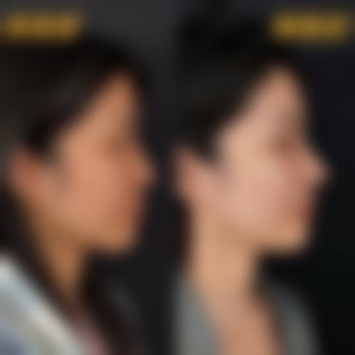 六、安庆石化医院医学美容中 心价格表