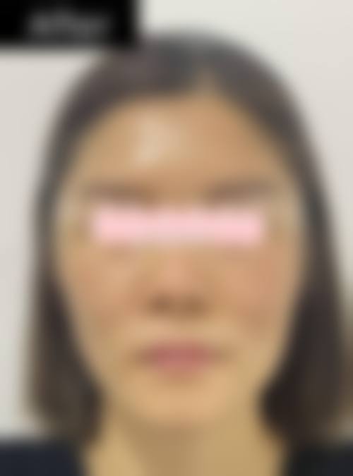 八、汕头陈静整形美容医院真实的患者评价