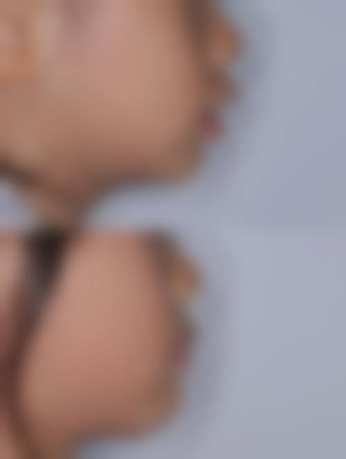 四、岷县滤镜主义整形医院特色项目