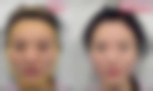 五、深圳南方激光整形美容价格表