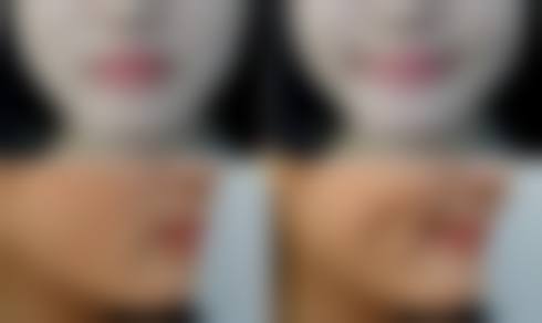 二、南宁脂美人整形美容医院怎么样？