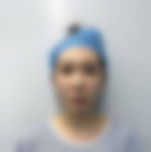 四、汕头陈静整形美容医院特色项目