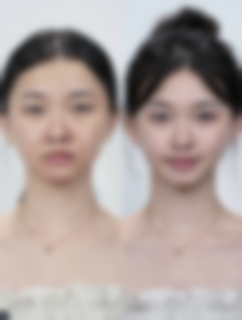 二、泉州黄氏医疗美容诊所怎么样？