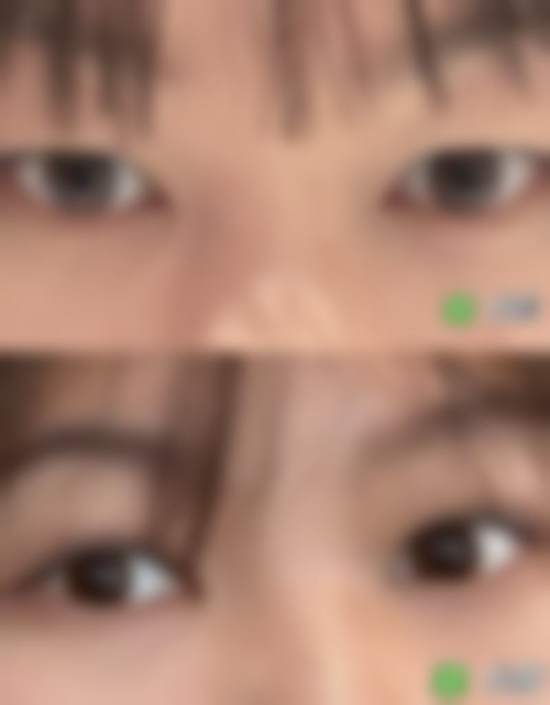 二、成都美钰蓉美整形医院怎么样？