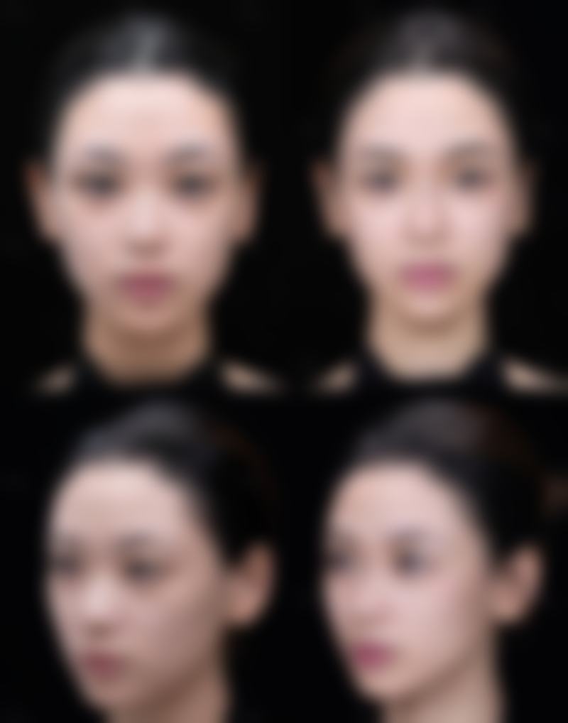 五、岷县滤镜主义整形医院价格表