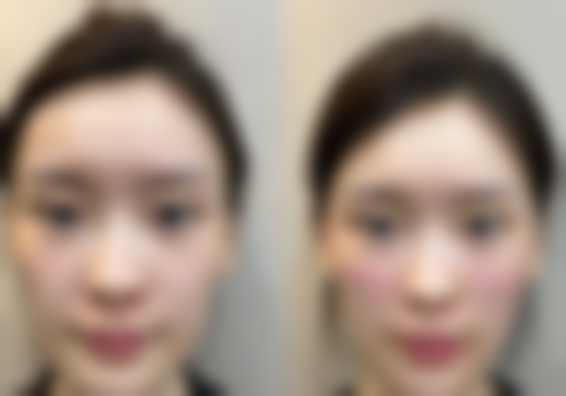 九、安庆石化医院医学美容中 心真实的患者评价