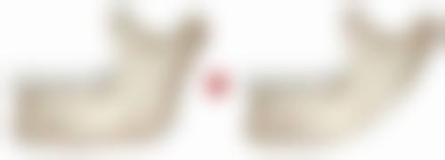 3点定位双眼皮能维持多久？并非永久！影响时长因素及延长妙招揭秘 