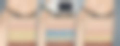 怎么快速去黑眼圈和眼袋？日常护理与医美手段全揭秘，教你重焕眼周光彩 