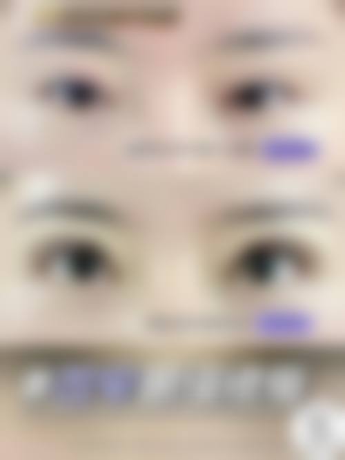 六、北京同仁医院价格表