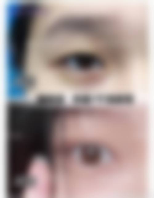 六、深圳春天阳光医院价格表