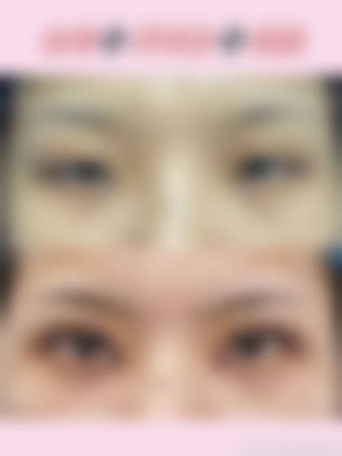 六、烟台鹏爱整形医院价格表